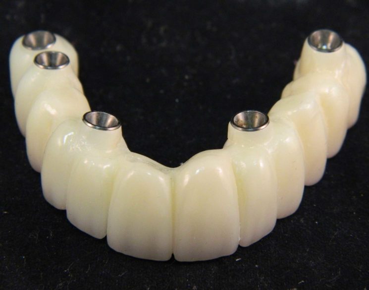 Fixed teeth acrylic