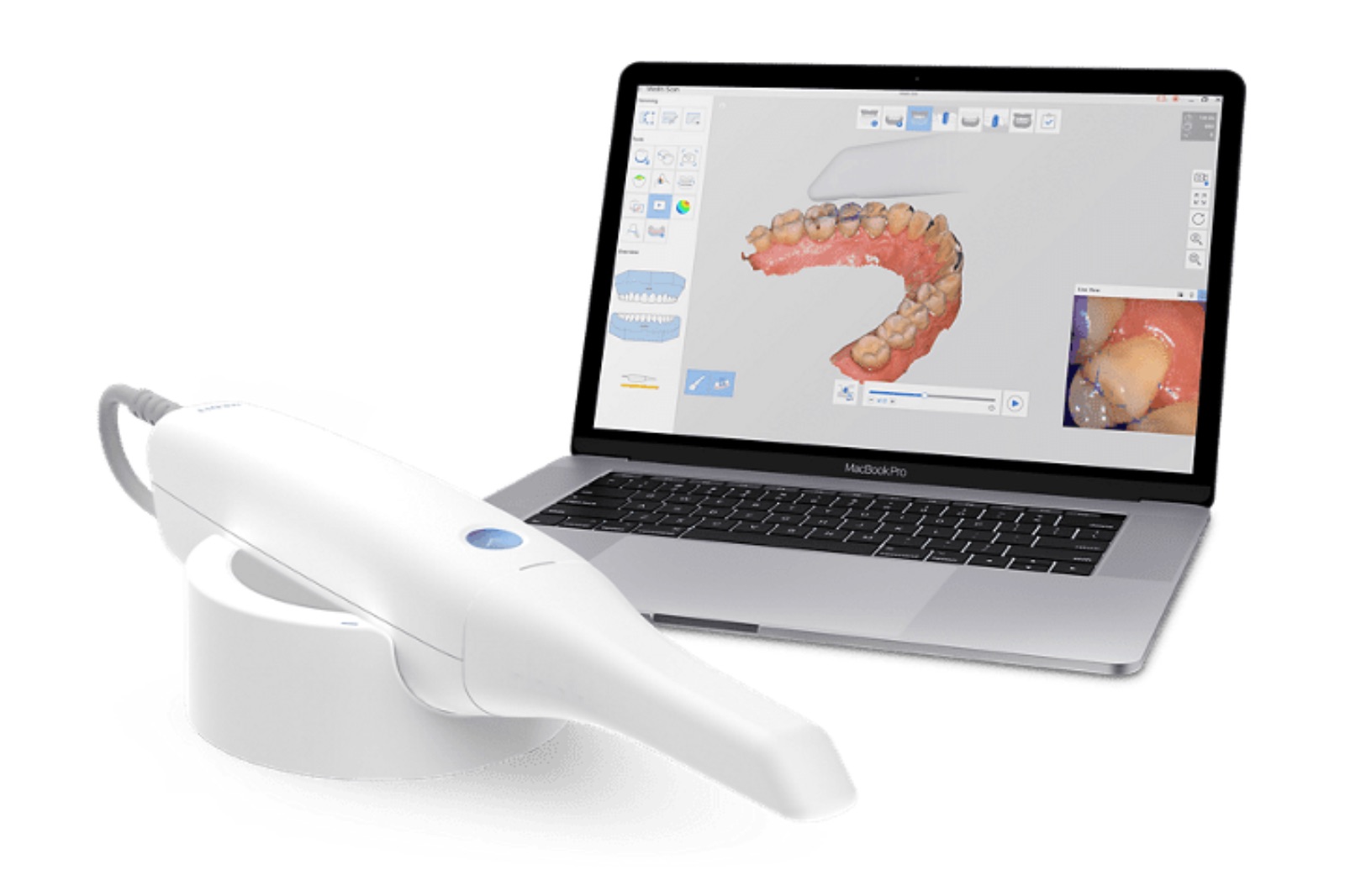 Medit intraoral scanner