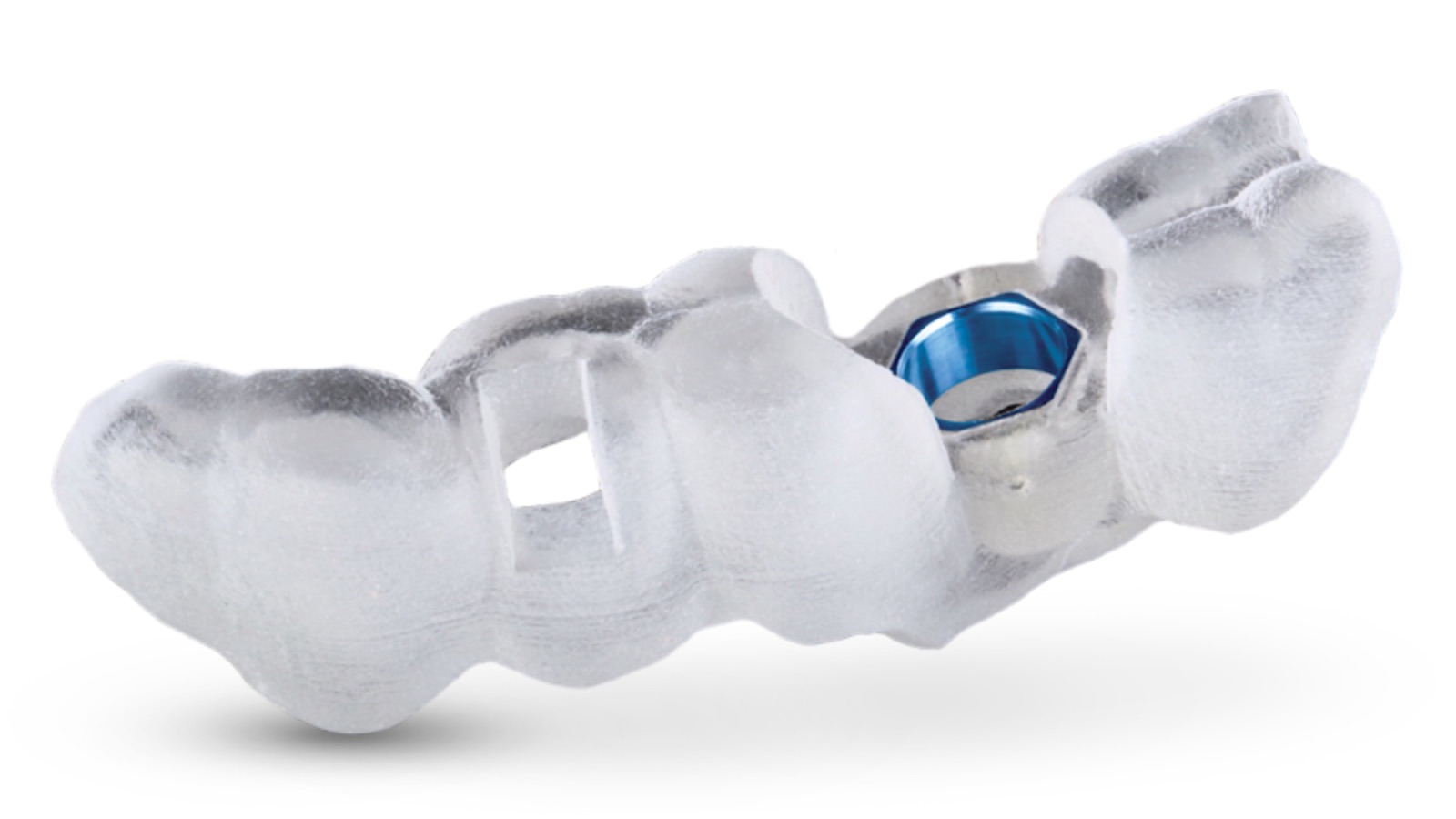 Single unit dental treatment plan
