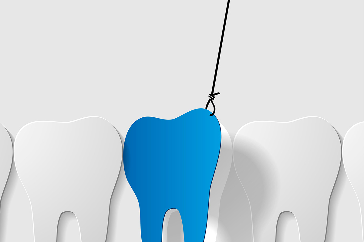 Tooth being pulled