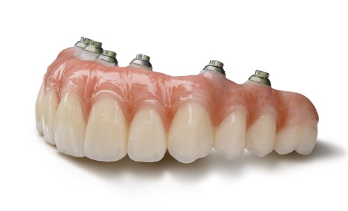 Premium zirconia fixed teeth